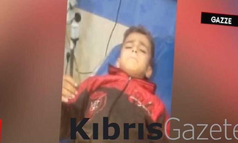 gazzede ameliyat sirasinda kuran i kerim okuyan cocuk UOPFYeFf