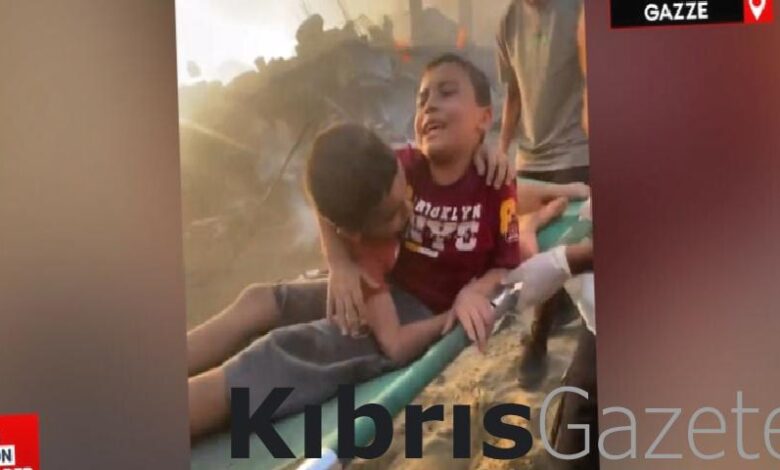israilin gazzeye saldirisindan yarali kurtulan kardesler rPuJvf6r