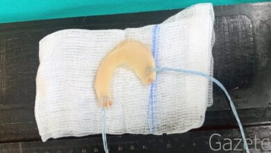 samsunda hali sahada dizini sakatladi meniskus nakli ameliyati yapildi 2BCuEILC