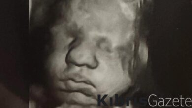 abddeki cift rahimli kadin ayni anda iki farkli bebege hamile kaldi kMkaw1LV