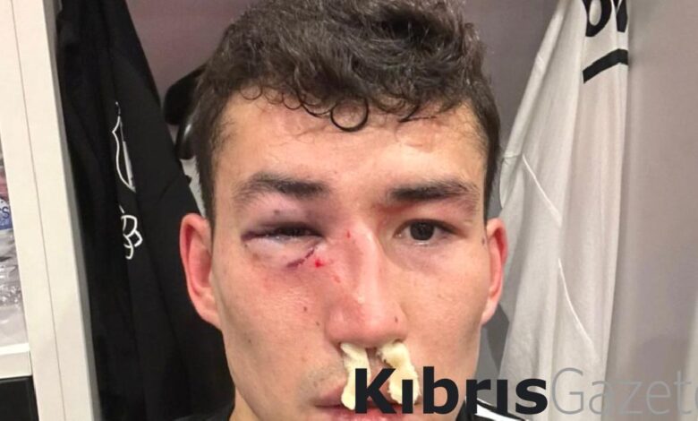 Bahtiyar Zaynutdinov sakatlandı, Beşiktaş'tan tepki geldi 1 bahtiyar zaynutdinov sakatlandi besiktastan tepki geldi XRIvNZyi