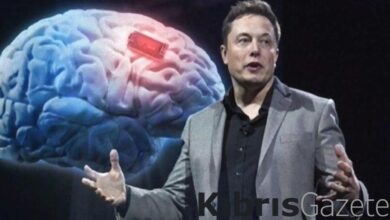 binlerce insan kafasina neuralink ciplerinden takilmasi icin basvurdu L1rmWV6e