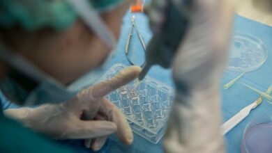 guney kibristaki pankreas kanseri rakamlari OOsxkyQm