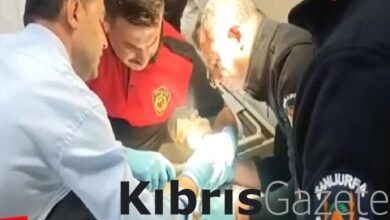 Şanlıurfa’da yemek yaparken elini karıştırıcıya sıkıştırdı 3 sanliurfada yemek yaparken elini karistiriciya sikistirdi P6SXfK6Q