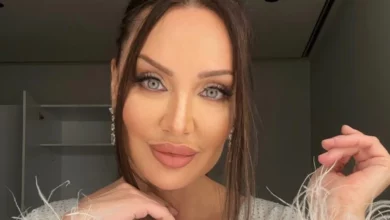 Son yaptırdığı estetik operasyon şoke etti! 1 son yaptirdigi estetik operasyon soke etti TDWg8vvF