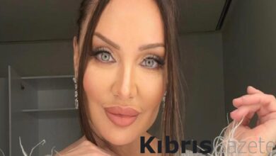 Umut Akyürek'in son yaptırdığı estetik operasyon şoke etti: Alın daraltma 2 umut akyurekin son yaptirdigi estetik operasyon soke etti alin daraltma wTVsY8j6