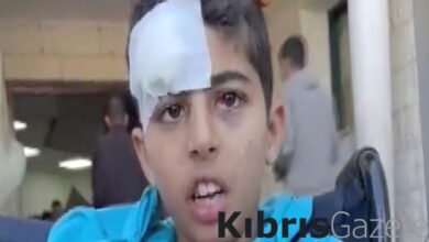 Filistinli yaralı çocuk, Cumhurbaşkanı Erdoğan'dan yardım istedi: Kolum çok sızlıyor... 1 filistinli yarali cocuk cumhurbaskani erdogandan yardim istedi kolum cok sizliyor YjiGDHBu