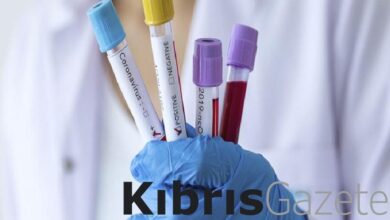 Güney Kıbrıs’ta 60 kişi koronavirüs tedavisi görüyor 1 guney kibrista 60 kisi koronavirus tedavisi goruyor ZUVgKlGw