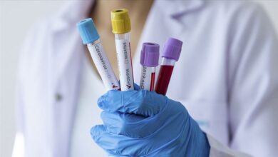 Güney Kıbrıs’ta koronavirüs dikey artışta 2 guney kibrista koronavirus dikey artista znzvDAdq