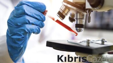 kan testiyle hizli ve yavas yaslanan organlar tespit edilebilir B6HKQNSB