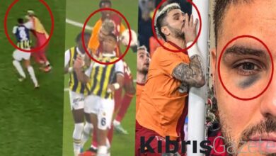 sosyal medya bunu konusuyor mauro icardinin gozu ne zaman morardi KyLAf5I8