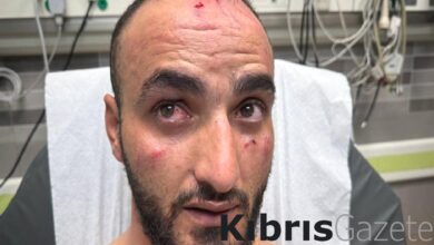 tufekle basina vurdular israil askerinin aa muhabirini darbettigi anlar nNnm6s1D