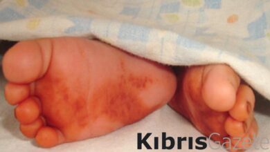 Ayak altına sirkeli kına sürün, gün yüzü görün... 1 ayak altina sirkeli kina surun gun yuzu gorun O3sIjTjF