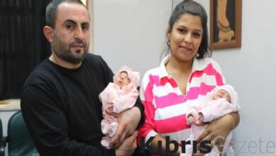 ayni damarlari paylasan ikizler anne karninda ameliyatla sagliklarina kavustu I9SBVhDj