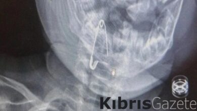 bitliste 8 aylik bebegin bogazina kacan cengelli igne operasyonla cikartildi a4zJN8IL
