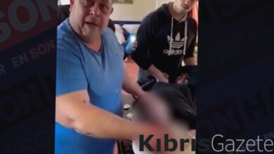 Gazze'deki doktor, yeğeninin bacağını anestezi olmadan kesmek zorunda kaldı 4 gazzedeki doktor yegeninin bacagini anestezi olmadan kesmek zorunda kaldi yzcbBUxd