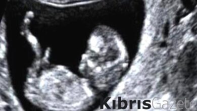 italyada ilginc olay erkek olmak icin ameliyata giren transin hamile oldugu ortaya cikti QANamyC3