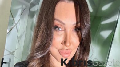 Umut Akyürek yüzünün son halini paylaştı! Takipçilerinden yorum yağdı 2 umut akyurek yuzunun son halini paylasti takipcilerinden yorum yagdi 9jMKGzDa