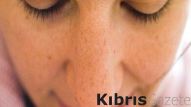 Cildinizde leke varsa doktora koşun: Kanser belirtisi olabilir 1 cildinizde leke varsa doktora kosun kanser belirtisi olabilir KBv6PHW2