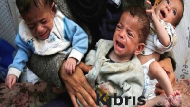 Gazze'de açlık derinleşiyor: Filistinli üçüz bebekler, ölüm tehlikesi altında 8 gazzede aclik derinlesiyor filistinli ucuz bebekler olum tehlikesi altinda rdaNabzy
